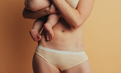 Poród naturalny a cesarskie cięcie – wady i zalety